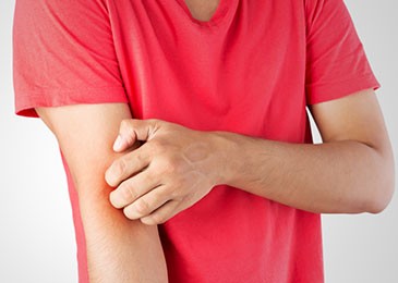 Fototherapie atopische Dermatitis: die natürliche Lösung