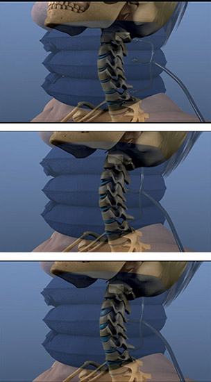 436_43984_necktrack3img.jpg